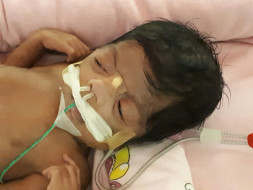 Help 2-Month-Old Samaira breathe on her own.