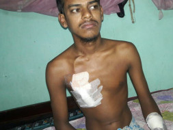 Help Abdur for Kidney Transplant