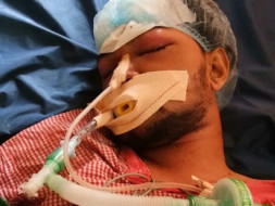 Help Ashwath Sapaliga to Stand Up Again