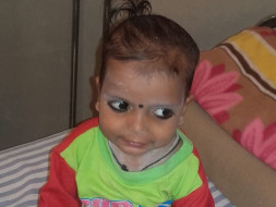 Help 2-Year-Old Viraj Fight Against Blood Cancer