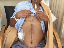 Help Sanjay To Fight Cancer
