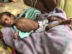 Save lives of 200 malnourished children in Rajasthan