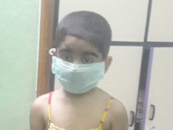 Post bmt treatment plz help
