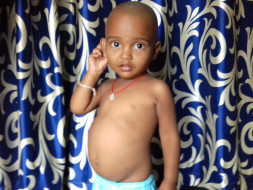 Help 2-year-old Akhilesh undergo a liver transplant