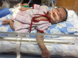 Help 25-days-old Baby Krishna Get Open Heart Surgery