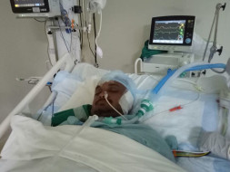 Mumbai Cobbler Is Struggling With Brain Injury From A Road Accident