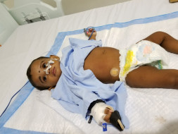 1-year-old Vyga with a swollen stomach needs help