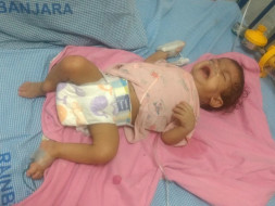Help 11-month baby Jai battle tuberculosis