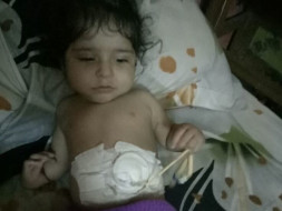 Help Yagyansh To Undergo Treatment And Lead A Normal Life