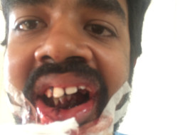 Help Vishnu To Put Smiles Back On Thousands Of Farmers And Kids