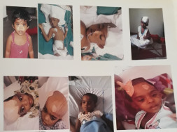 Help Hepsiba Fight A Serious Head Injury