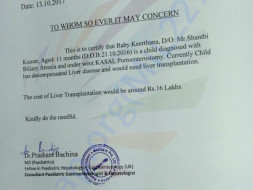 Help 11-Month-Old Keerthana To Undergo Liver Transplant