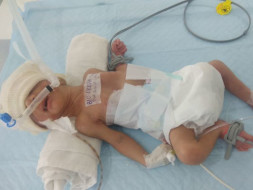 Manoj's 14-Day-Old Son Needs Your Support To Live