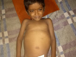 4-year-old Manish urgently needs a liver transplant to survive