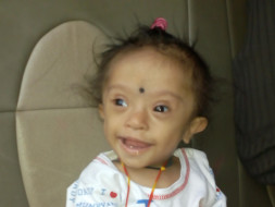 Help Baby Rudraksha For His Heart Surgery