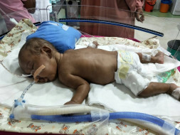 Help Baby of Karthika to See World After an Year of Struggle