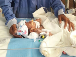 Help Bhagya's baby fight a severe stomach disease