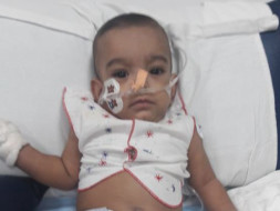 8-month-old Bhavya Is In Respiratory Distress And Needs Your Help