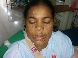 Help My Mother Who Met With A Train Accident
