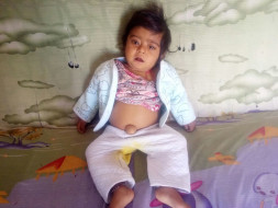 He Needs An Urgent Liver Transplant To Stay Alive For His 1st Birthday