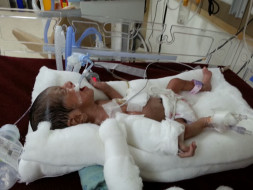 2 Wks Old Baby is Critically Ill & On Ventilator Needs Your Help