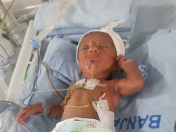 Save Baby Mokshith Who Was Born At 5 Months