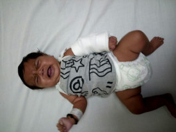 My 3-Month-Old Daughter Urgently Needs a Heart Surgery to Survive