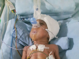 Save mokshith premature baby