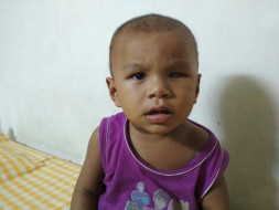 1-year-old Dhanjit Has Eye Cancer And Needs Our Help For Treatment
