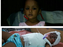 3-Year-Old Poornima Needs OurHelp