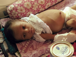 Help 6-Month Samriddho Fight A Severe Liver Disease & Bloated Stomach