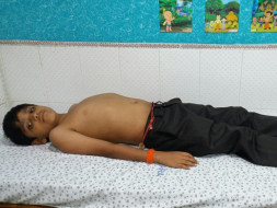 Help 13-year-old Nagendra fight end stage liver failure