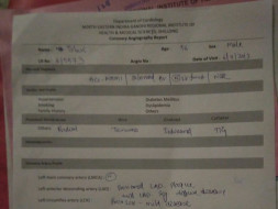 Need financial aid for heart surgury,