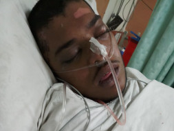 To Give New Life To A 20-Year-Old Who Met With An Accident
