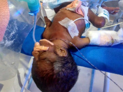 Please Help Newborn Baby in Critical Condition In Hyderabad
