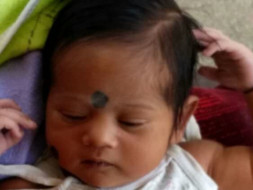 One Month Old Baby Needs Your Support For A Heart surgery
