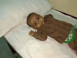Help 10-month-old baby Masrur fight a severe heart disease