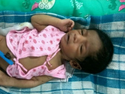 Kasthuri's baby fights for her life due to a severe heart disease