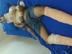 Help Tanmoy to Lead Normal Life and Aid His Widow Mother