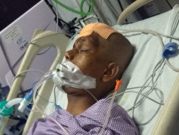 Head injured - complicated operation in head