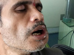 Help Vikas Fight Against Cancer
