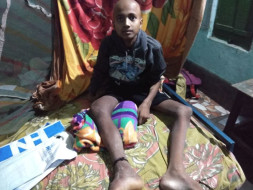 Help 14-year-old Boy Whose Parents Don't Understand He Has Bone Cancer