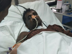 Nataraj met with an accident and is now suffering from internal damage