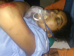 Help A Teenager Anusha Survive An Accident