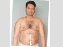 Help Mahaboob fight cancer