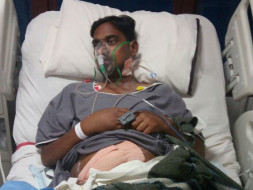 Save 34-Year-Old Pradeep Kumar Undergo Kidney Transplantation