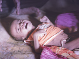 Help Melghat Childrens Fight Malnutrition