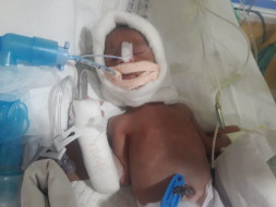 Help Mona and her Premature Infant