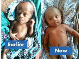 Save lives of 100 malnourished children in Palghar, Maharashtra.
