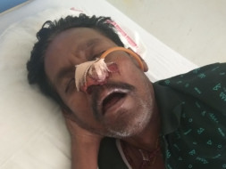 Help Calvin Fight Cancer